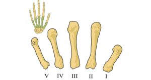 Come possiamo prevenire osteoporosi